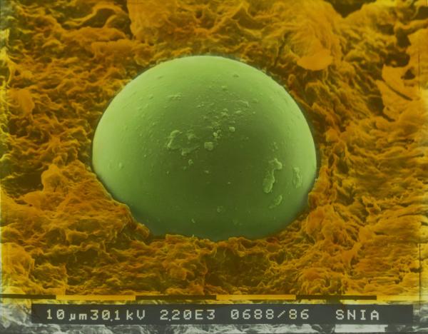 Snia Fibre - Cesano Maderno - Microscopio elettronico - Difetto di materiale tessile