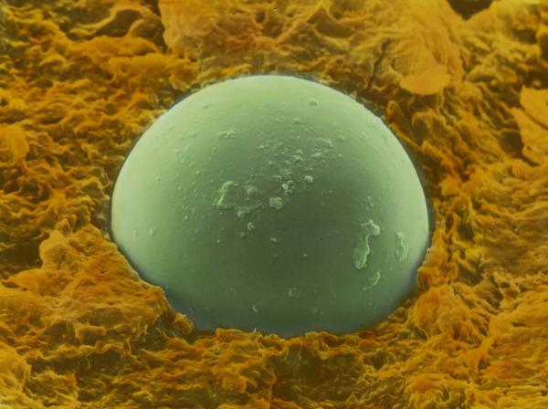 Snia Fibre - Cesano Maderno - Microscopio elettronico - Difetto di materiale tessile