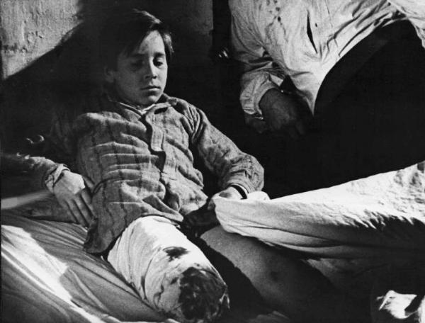 Scena del film "Altri tempi" - Regia Alessandro Blasetti - 1951 - Un bambino su un letto con una gamba amputata