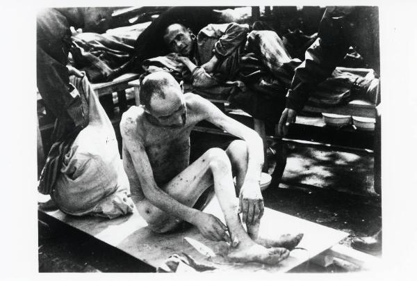 Seconda guerra mondiale - Repubblica Ceca - Campo di concentramento e ghetto di Theresienstadt (Terezin) - Nazismo - Liberazione - Ritratto maschile: prigioniero scheletrito sopravvissuto