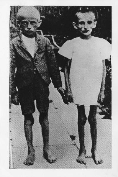 Seconda guerra mondiale - Polonia - Campo di concentramento di Auschwitz (?) - Nazismo - Dopo la liberazione - Ritratto infantile: due bambini gemelli scheletriti vittime degli esperimenti di Josef Mengele (?)