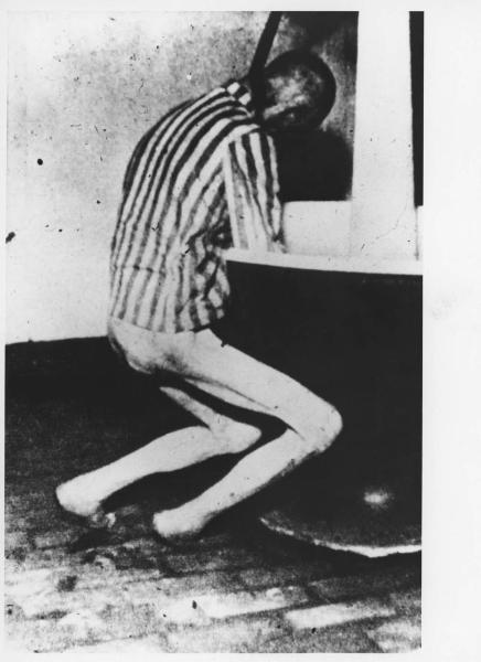 Seconda guerra mondiale - Nazismo - Campo di concentramento - Prigioniero con corda al collo vittima di esperimenti