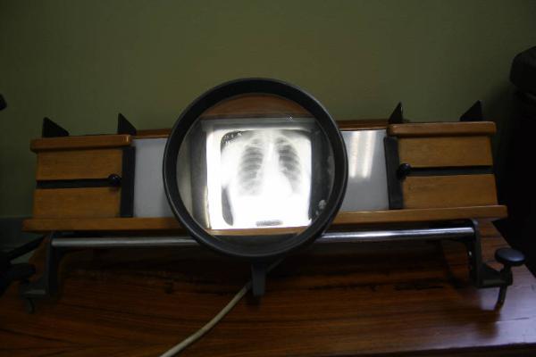 Visore per lastre radiografiche TSV 2 Old Delft - Holland - visore per lastre radiografiche - medicina e biologia