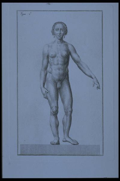 Studio anatomico dell'ermafrodito Giacoma Fiorini