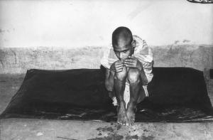 India. Giovane denutrito accovacciato a terra su un telo di plastica