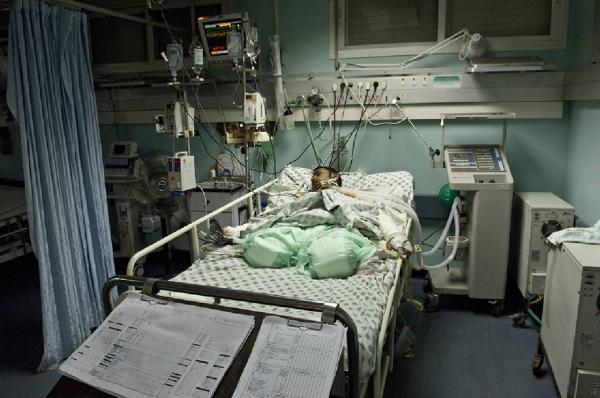 Territori occupati palestinesi. Palestina, Striscia di Gaza - Ospedale - Stanza, interno - Ritratto maschile: uomo combattente in letto di ospedale con gambe amputate e intubato