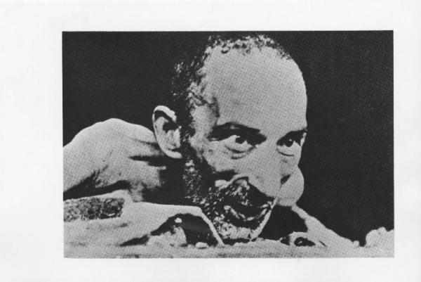 Seconda guerra mondiale - Germania - Campo di concentramento di Buchenwald - Nazismo - Liberazione - Ritratto maschile: volto di un prigioniero sopravvissuto scheletrito