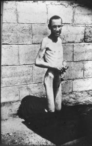 Seconda guerra mondiale - Campo di concentramento - Nazismo - Dopo la liberazione - Ritratto maschile: prigioniero nudo scheletrito sopravvissuto, in ginocchio