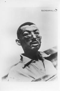 Seconda guerra mondiale - Germania - Campo di concentramento di Buchenwald - Nazismo - Liberazione - Ritratto maschile: prigioniero con volto tumefatto - Tortura