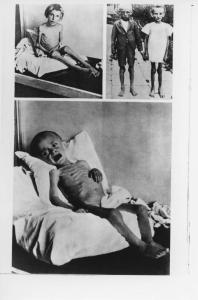 Seconda guerra mondiale - Nazismo - Polonia - Campo di concentramento di Auschwitz (?) - Liberazione - Bambini scheletriti sopravvissuti vittime degli esperimenti di Josef Mengele (?)